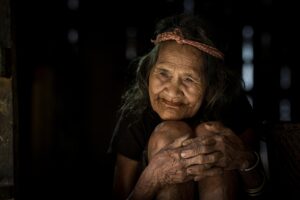 女性の植毛にかかる医療費控除の申請方法は？